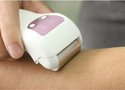 Electrolysis-Hair-Removal-at-Home